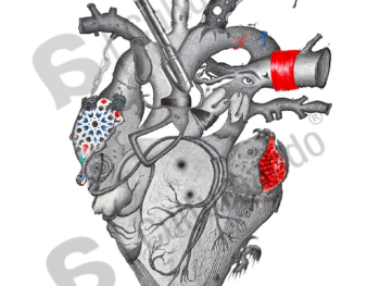 {{brizy_dc_image_alt entityId=